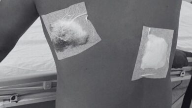 Photo of Expolicía sobrevivió a un ataque para echar el cuento