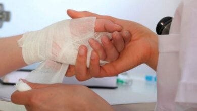 Photo of En Córdoba van 20 quemados por manipulación de pólvora