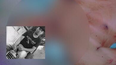 Photo of Nuevo ataque sicarial dejó a un hombre sin vida en Cantaclaro
