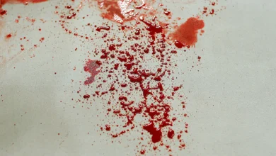 Photo of Hombre falleció tras golpear una ventana de vidrio y cortarse una vena