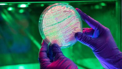 Photo of Agrosavia reconoce la grave situación fiscal por la que atraviesa el país y las acciones que se han tomado desde el Ministerio de Hacienda